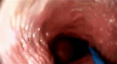 camera inside vagina gif - XXGASM