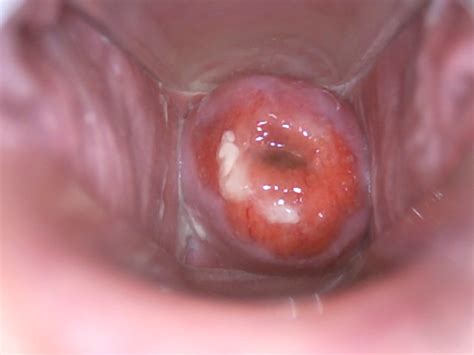 camera inside vagina during sex - XXGASM