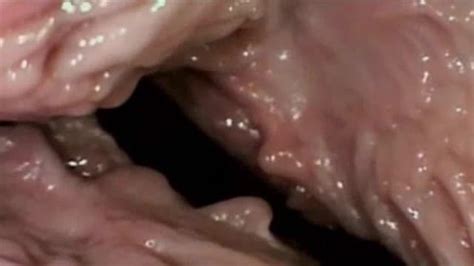 no sound: see inside the vagina during sex : xxxbunker.com ...