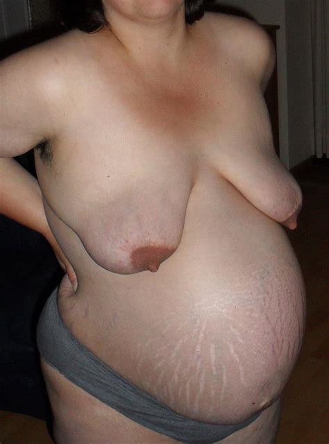 Wrinkled Stretched Tits Cumception Stretch Mark Pussy