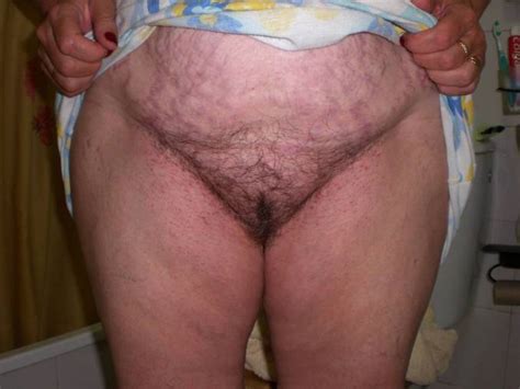 Stretch Mark Pussy 66910 | stretchmark belly chubby granny