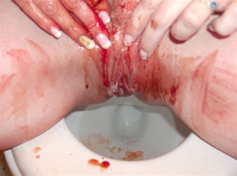 Bleeding on pussy image - Porn archive